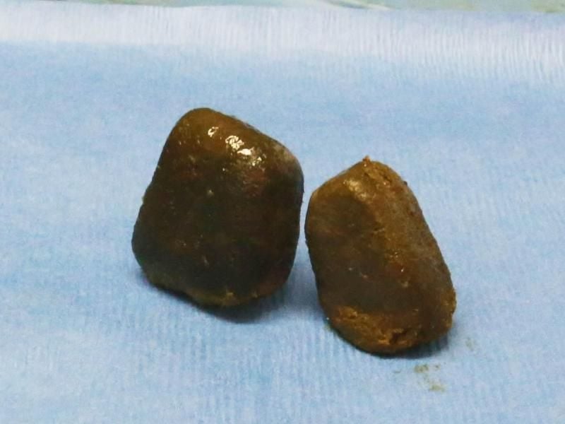 Kot von Wombats. Wissenschaftler haben herausgefunden, wie Wombats ihren würfelförmigen Kot produzieren. Foto: P. Yang and D. Hu/Georgia Tech/AlphaGalileo