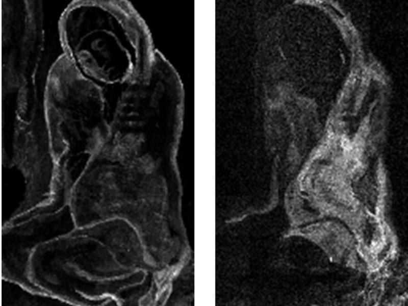 Röntgenaufnahmen des Gemäldes „La Miséreuse accroupie” aus dem Jahr 1902 von Pablo Picasso. Foto: Northwestern University/Art Institute of Chicago Center for Scientific Studies in the Arts
