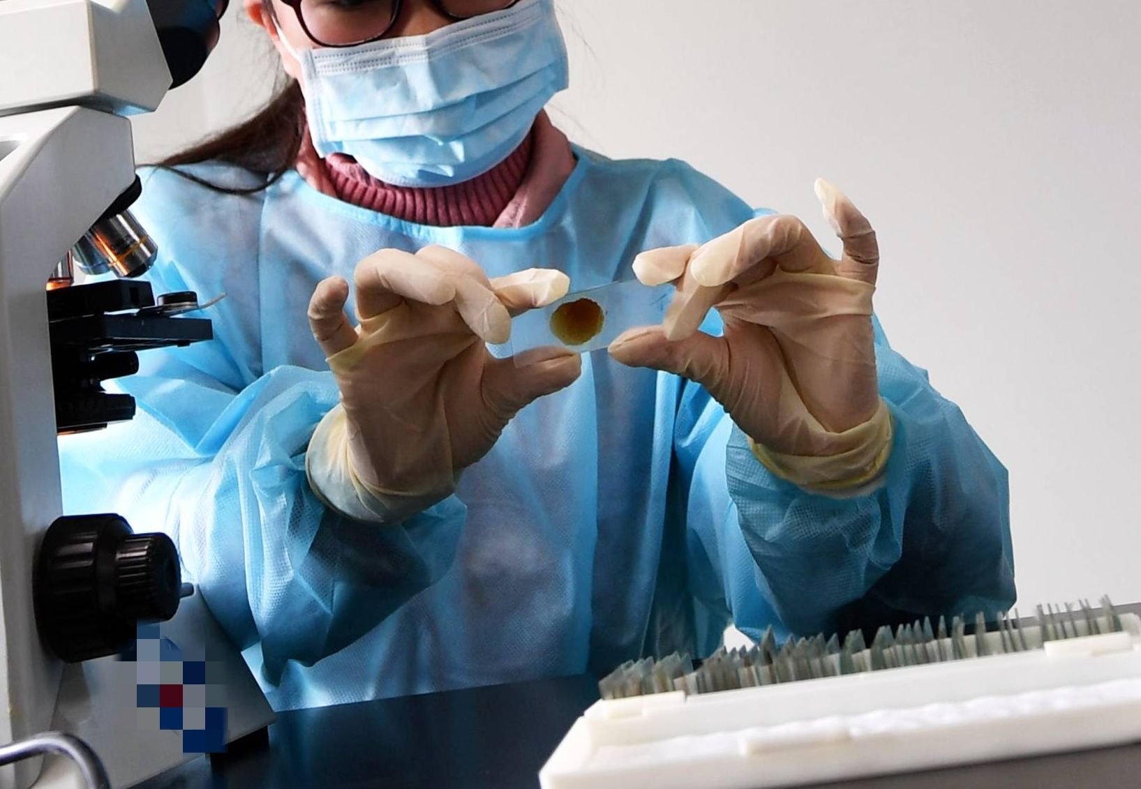 In einem Labor werden Tests auf eine mögliche Tuberkulose-Infektion durchgeführt