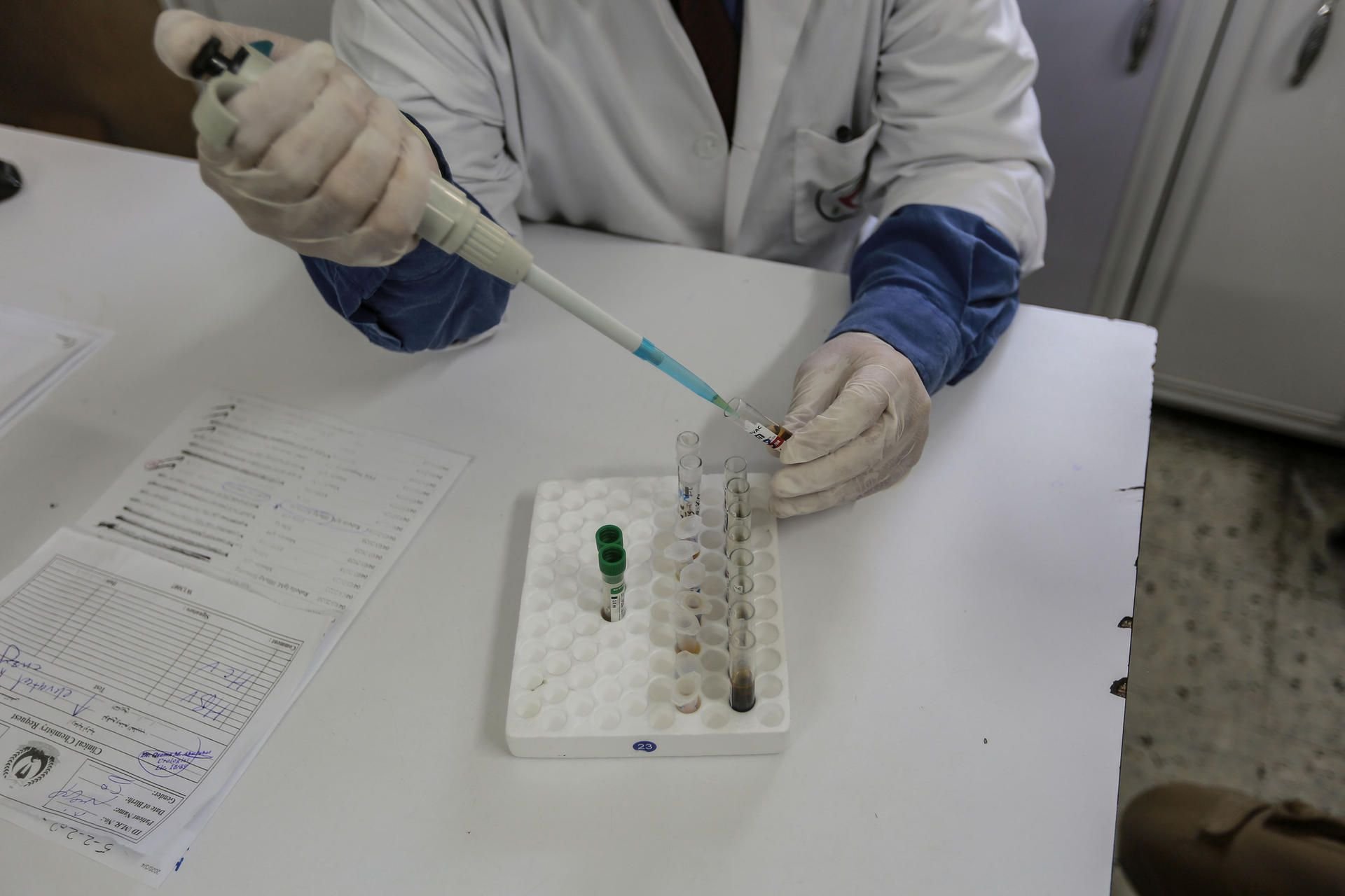 Ein Arzt untersucht eine Blutprobe auf das Coronavirus.
