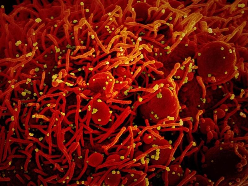 Auf dieser Aufnahme ist eine Zelle (rot) mit dem Coronavirus (SARS-CoV-2, gelb) infiziert. Foto: Niaid/Europa Press/dpa