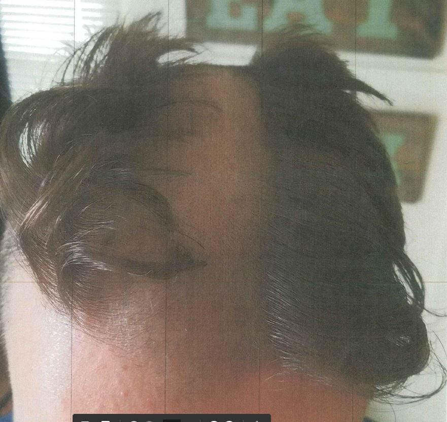 Die Frisur eines 22-Jährigen im US-Bundesstaat Wisconsin erinnert stark an Larry Fine aus „Three Stooges“.