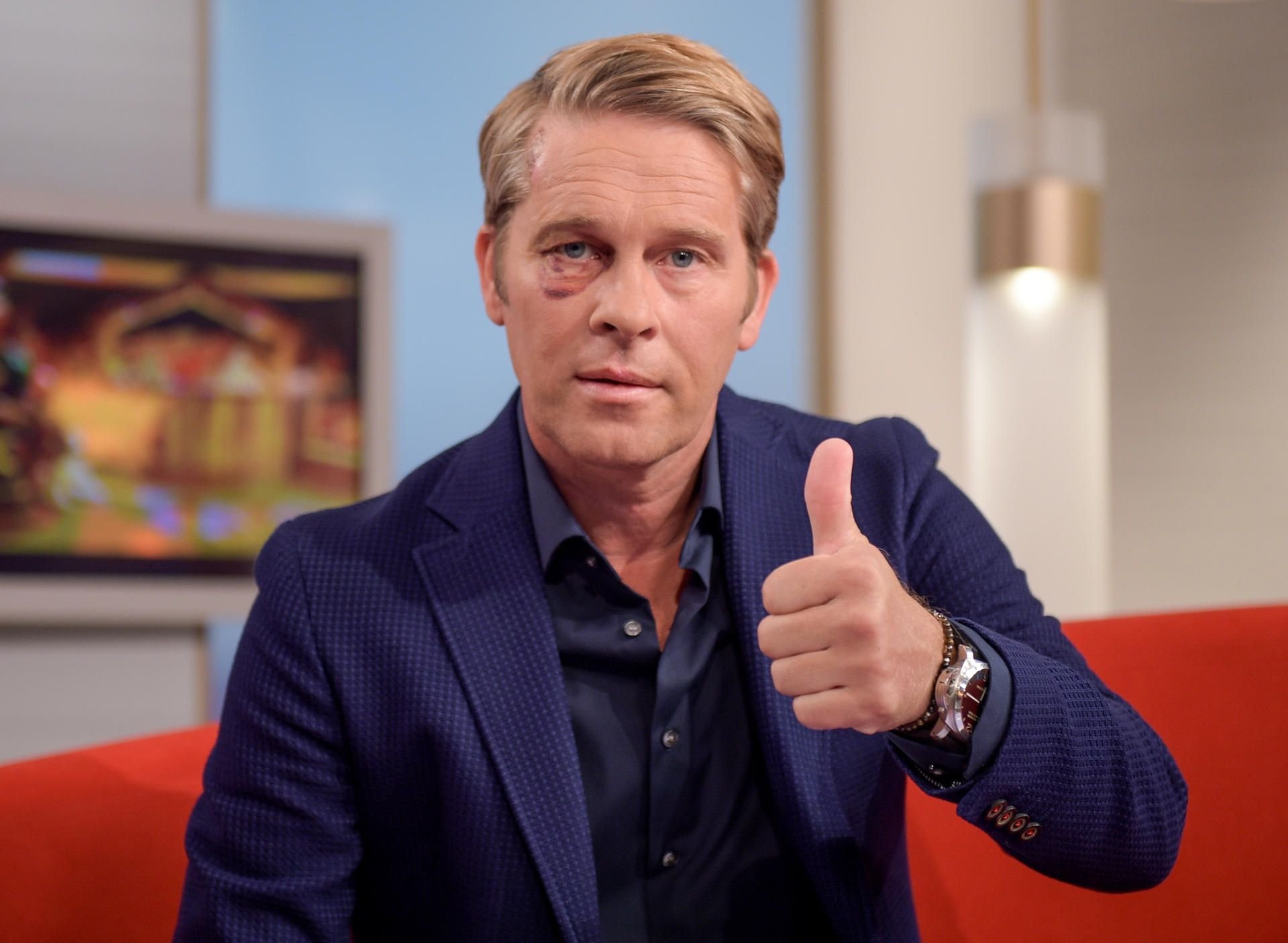 Hinnerk Baumgarten hat eine Woche nach der Prügelattacke gegen ihn erstmals wieder die Sendung „DAS!“ im NDR moderiert.