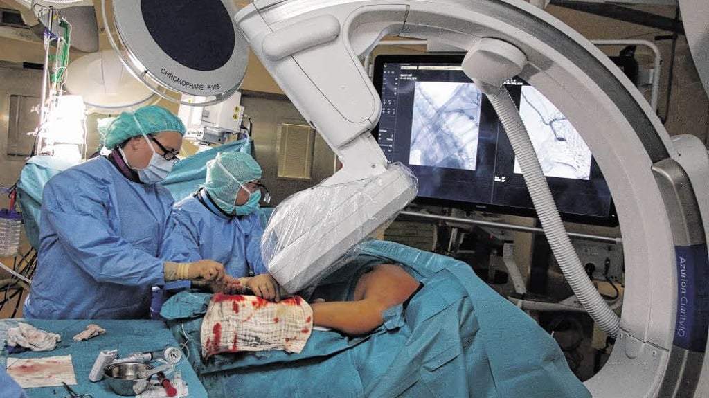 Chefarzt Matthias Lenk mit seinem Team bei der Operation im Hybrid-Operationssaal. Im Vordergrund ist die Röntgeneinheit zu sehen.