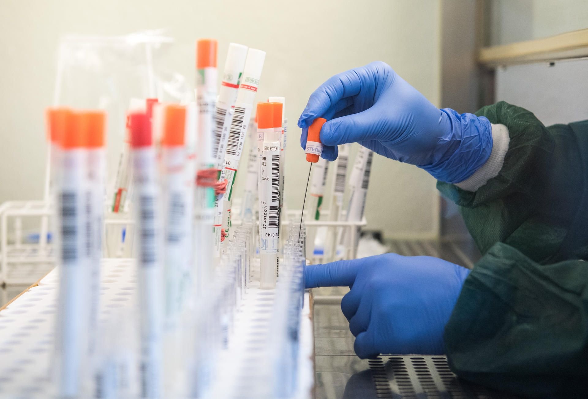 Der SARS-CoV-2-Virus sorgt in vielen Labors für Betrieb.