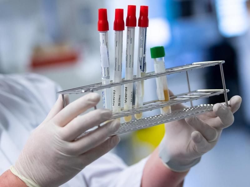 Eine Laborantin bereitet Corona-Proben für die weitere Analyse vor. Foto: Sven Hoppe/dpa/Symbolbild