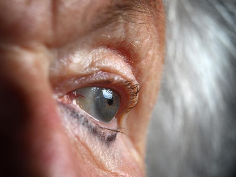 Laut einer Studie leiden mehr ältere Menschen an einer Depression als bisher vermutet. Foto: Karl-Josef Hildenbrand