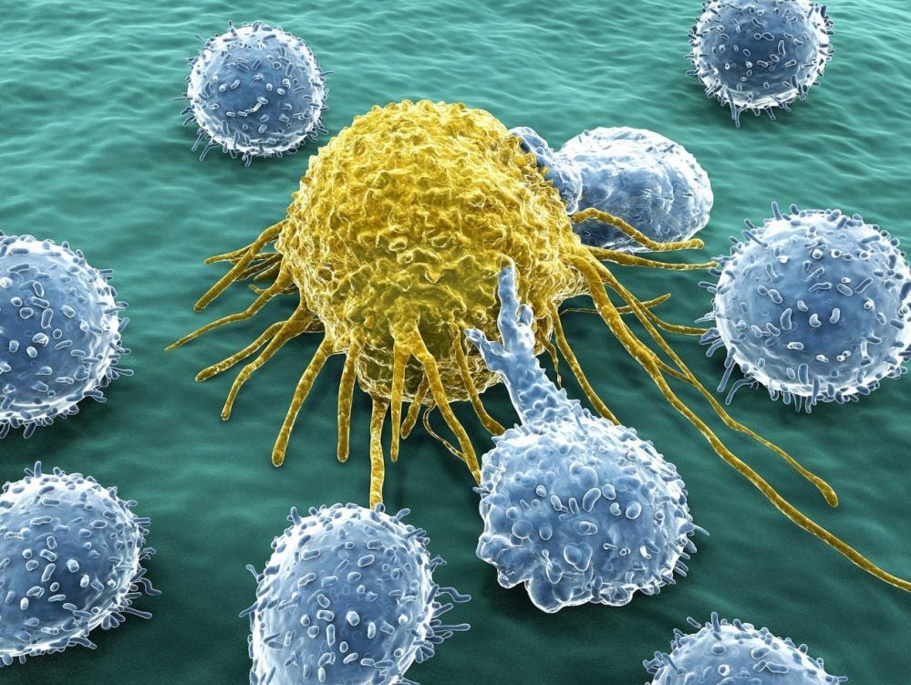 Bei der Immuntherapie zerstören Antikörper (blau) gezielt die Krebszellen (gelb). Das Verfahren findet immer mehr Anwendung.