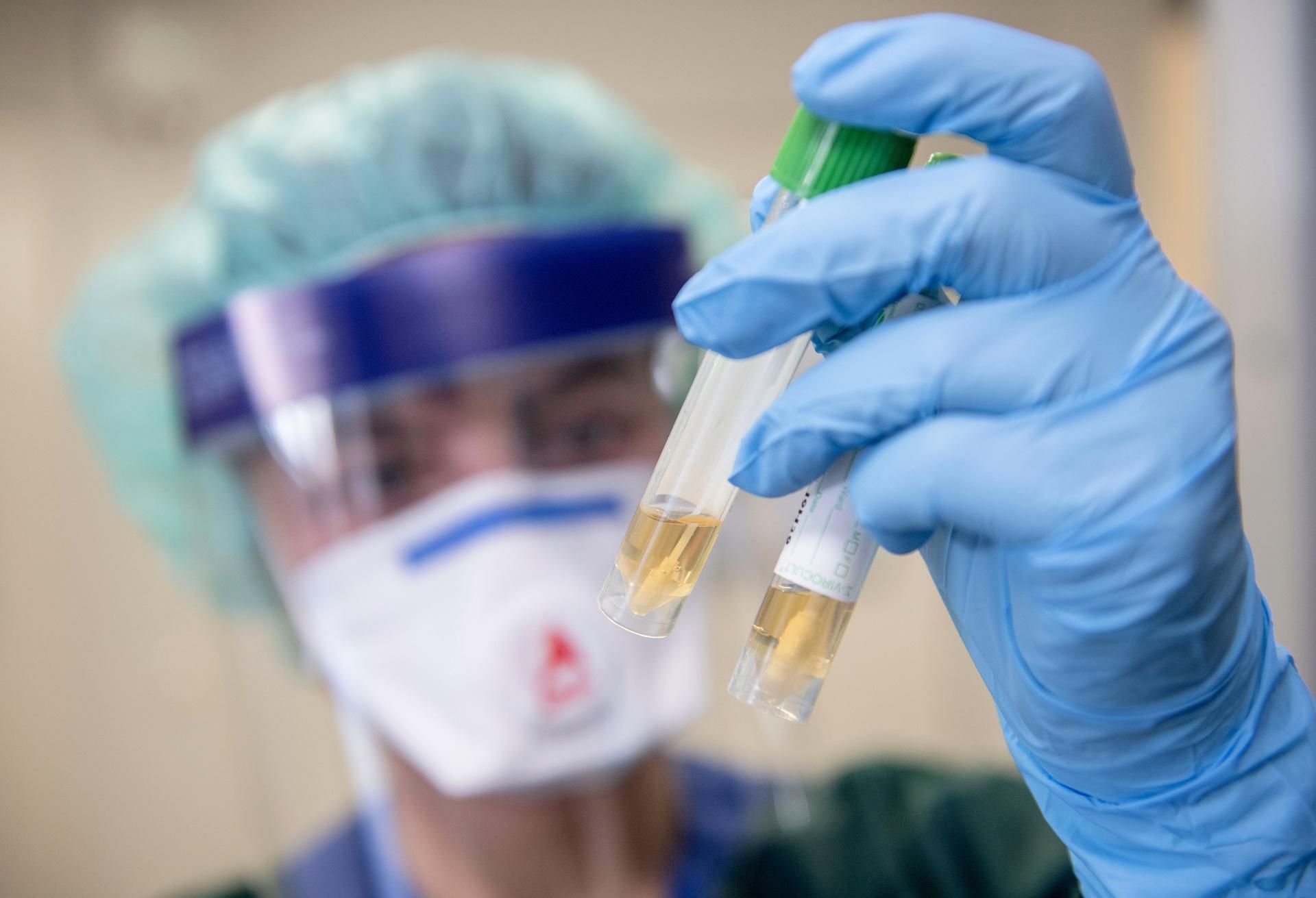 Eine Krankenschwester auf der Infektionsstation der Uniklinik Essen betrachtet in Schutzkleidung und mit einer Atemmaske zwei Abstrichröhrchen, nachdem ein Patient in NRW erkrankt ist.