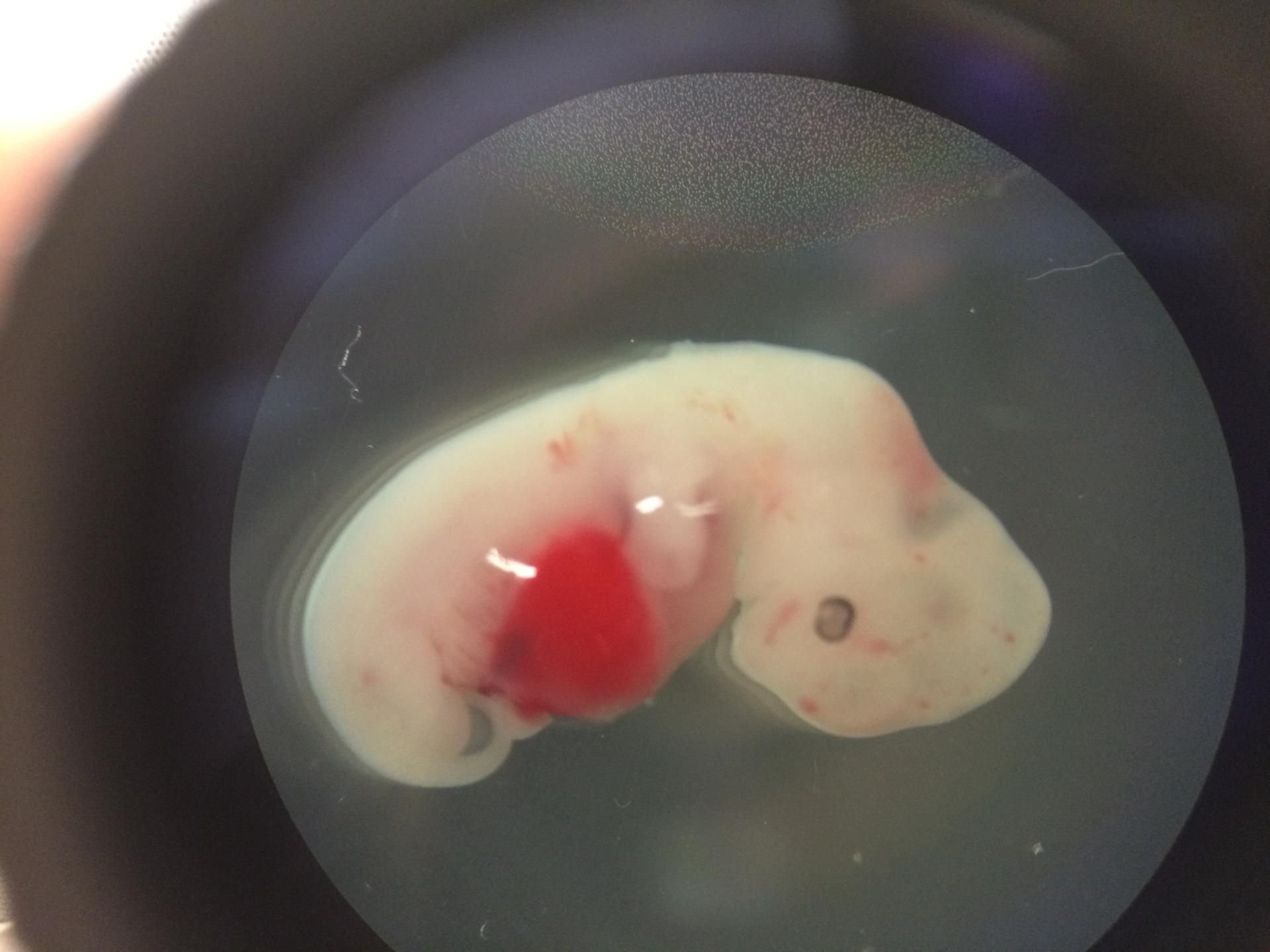 Ein Mensch-Schwein-Embyo, vier Wochen alt, entstanden aus befruchteter Eizelle und menschlichen Stammzellen.