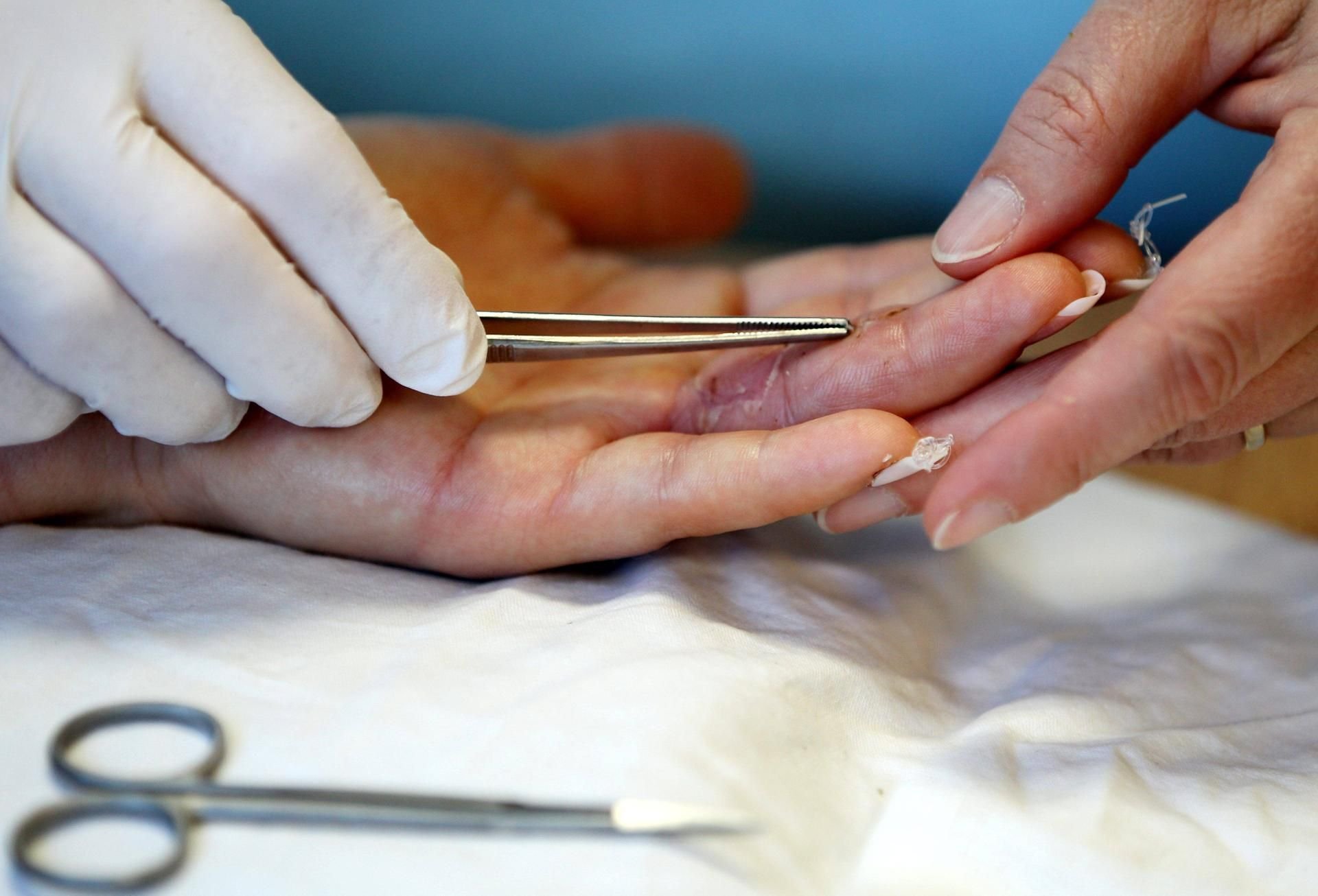Eine verletzte Hand wird behandelt.