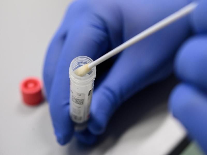 Ein Mann zeigt einen Abstrich für das Testverfahren auf das Virus SARS-CoV-2. Foto: Sebastian Gollnow/dpa/Symbolbild