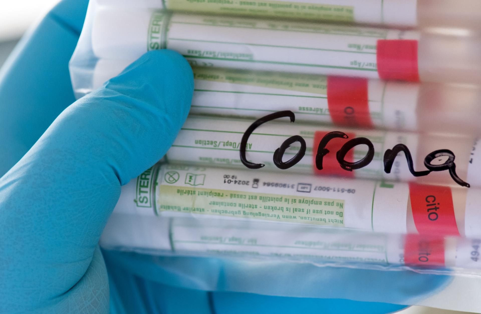rotz Personalmangel im halleschen Gesundheitsamtes sieht Amtsärztin Christine Gröger Halle gut vorbereitet, sollte es zu einer zweiten Corona-Welle kommen.