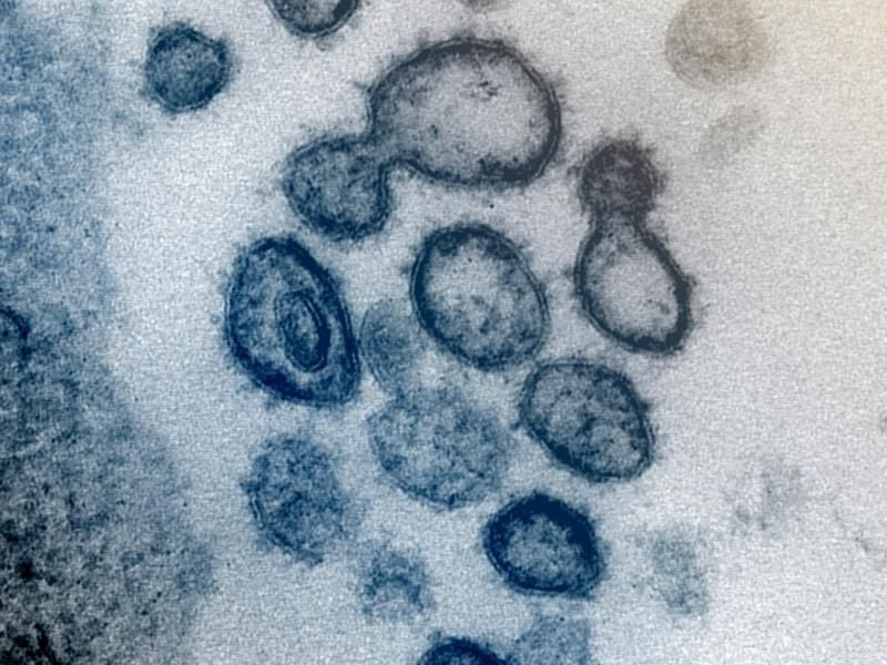 Elektronenmikroskopische Aufnahme des neuartigen Coronavirus SARS-CoV-2. Foto: Uncredited/NIAID-RML/AP/dpa/Archivbild