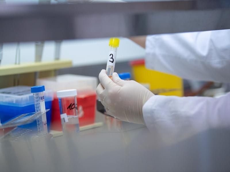 Eine Frei zeigt in einem Labor einen Test für das neuartige Coronavirus. Foto: Sebastian Gollnow/dpa/Symbolbild