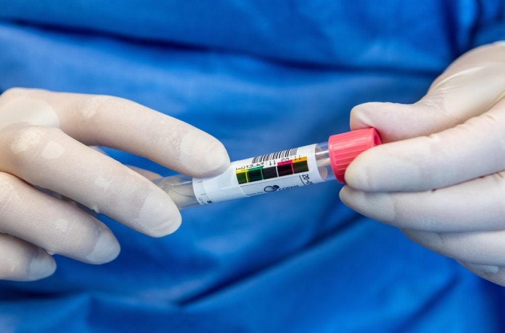 Röhrchen mit der Probe eines Corona-Patienten