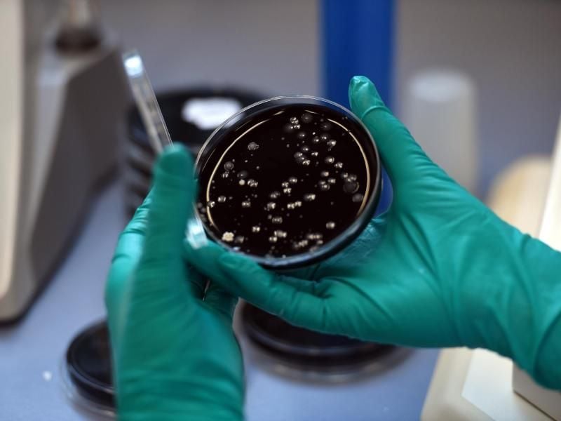 Nach der wochenlangen Schließung von Hotels, Sportanlagen und Schwimmbädern könnten die Trinkwasseranlagen vermehrt mit Legionellen belastet sein. Foto: picture alliance / dpa