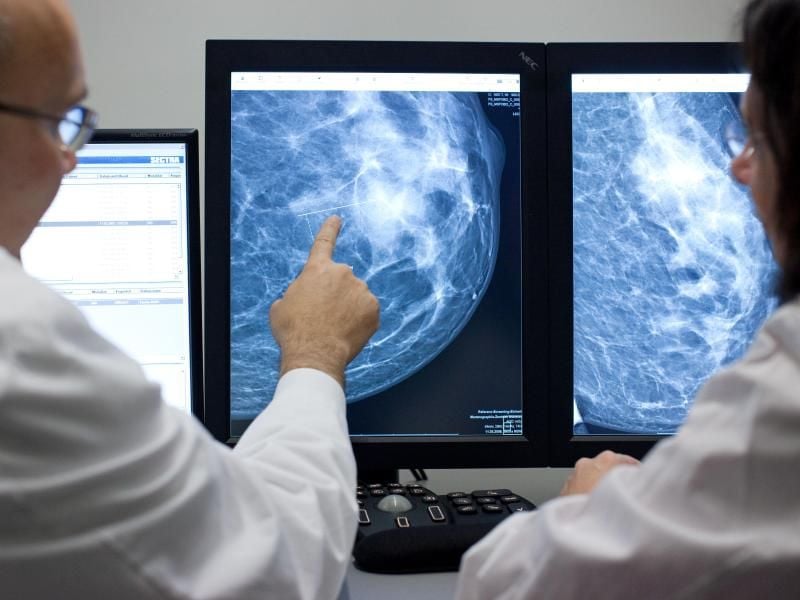 Der Radiologe Dr. Walter Heindel deutet im Referenzzentrum Mammographie am Universitätsklinikum Münster (UKM) auf eine Auffälligkeit in einer weiblichen Brust, dargestellt auf einem Computermonitor. Foto: Friso Gentsch