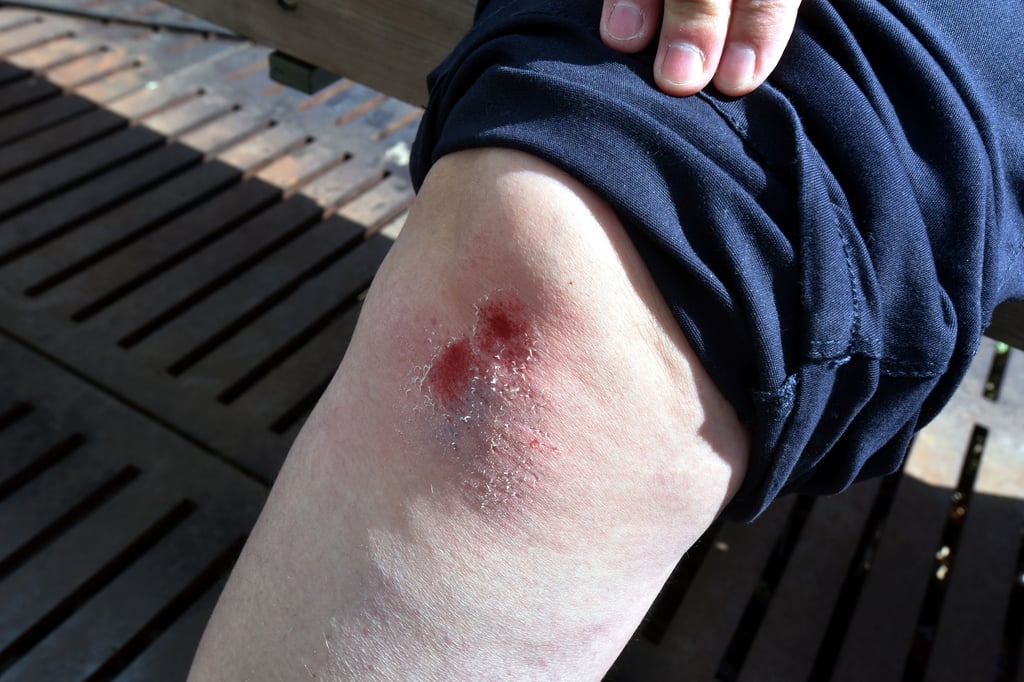 Die Regenrinne am Weißenfelser Markt verursachte so manchen Bürger nicht nur ein blutiges Knie.