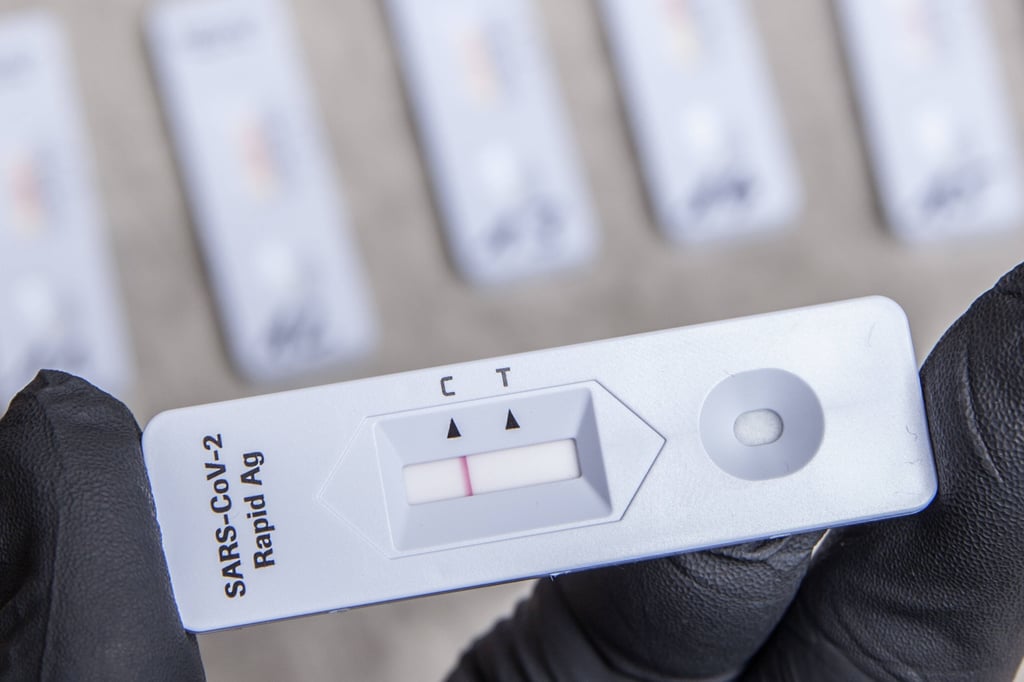 Wer nicht geimpft oder genesen ist, muss in den meisten Fällen einen negativen Coronatest vorlegen.