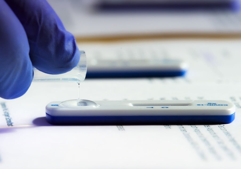 Die Testflüssigkeit eines Corona-Schnelltests wird ausgewertet.