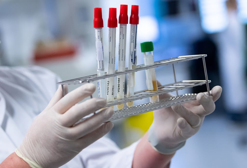 Eine Laborantin bereitet Corona-Proben für die weitere Analyse vor.