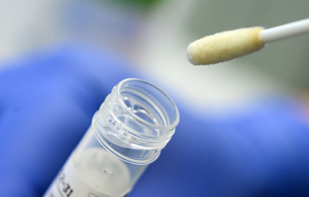 Ein Abstrich für das Testverfahren auf das Coronavirus ist zu sehen.