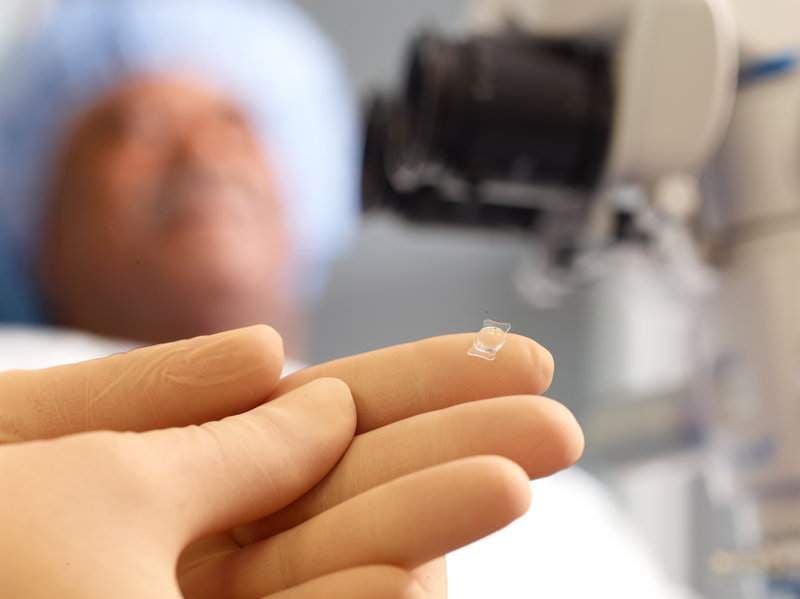 Kunstlinsen bei Grauem Star