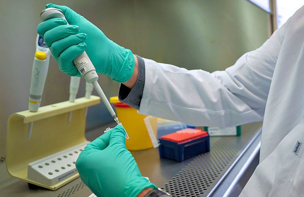 Die Variante Alpha, auch als britische Variante bekannt, ist im Salzlandkreis die am häufigsten gefundene Mutation.