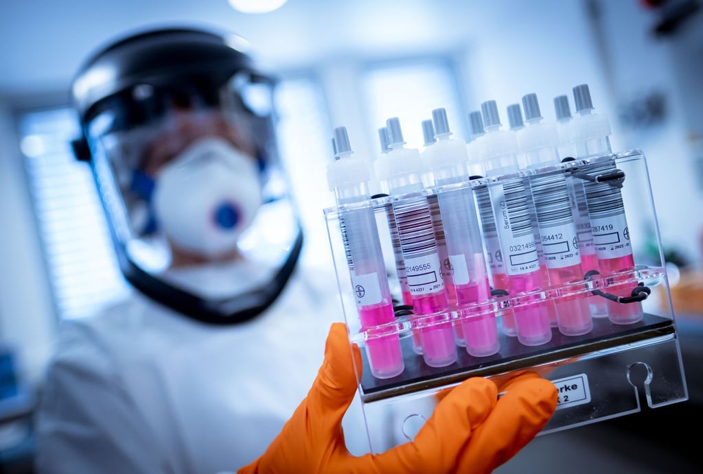 Eine wissenschaftliche Mitarbeiterin hält Coronavirus-Testproben in der Hand.