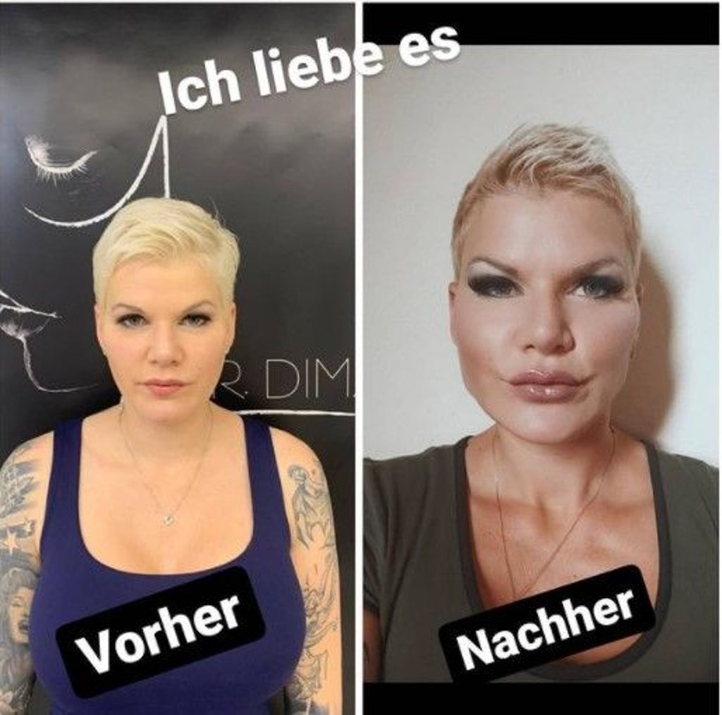 Schönheits-OP Bilder: Vorher & Nachher - Zeichnen lernen mit Spaß!