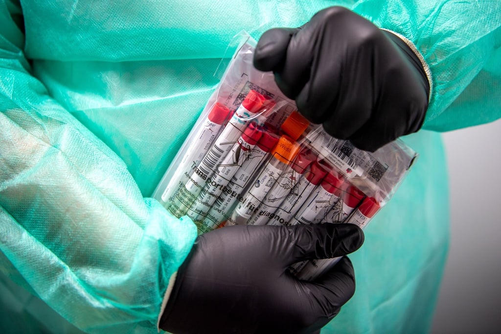 Proben für einen PCR-Test werden von einem Laboranten verpackt.