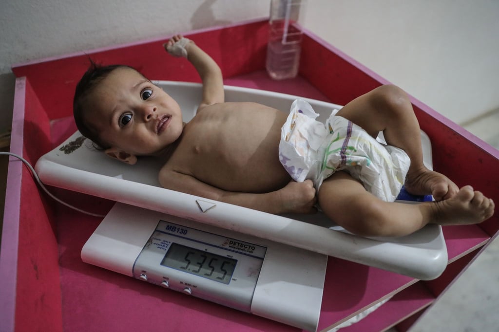 Eine Krankenschwester ermittelt das Gewicht eines unterernährten Kindes im Ibn Sina Krankenhaus in Idlib. Das Welternährungsprogramm (WFP) geht von 270 Millionen Menschen aus, die in 2021 akut an Hunger leiden oder davon stark gefährdet sein werden.