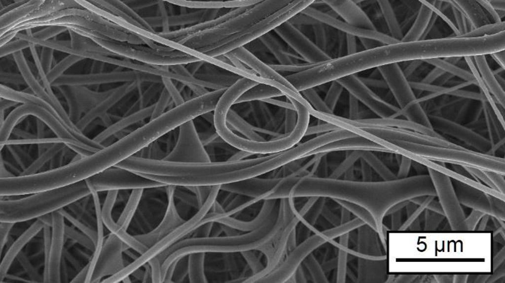 Mikrostruktur eines Tropoelastin-Vlieses, das mit Formaldehyd vernetzt worden ist (Aufnahme im Rasterelektronenmikroskop).