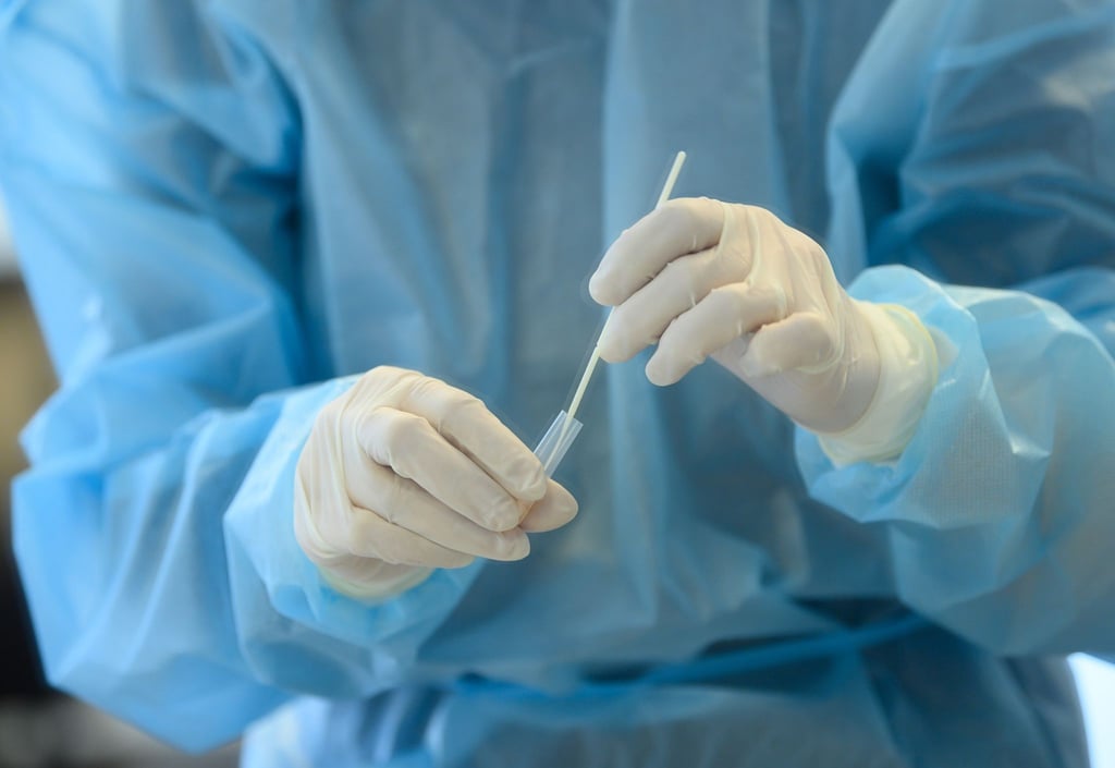 Eine Mitarbeiterin wertet einen Antigen-Schnelltest auf das Coronavirus aus. Die Inzidenz war in der Pandemie bisher Grundlage für viele Corona-Einschränkungen, etwa im Rahmen der ausgelaufenen Bundesnotbremse. Künftig sollen nun weitere Werte wie Krankenhauseinweisungen stärker berücksichtigt werden.