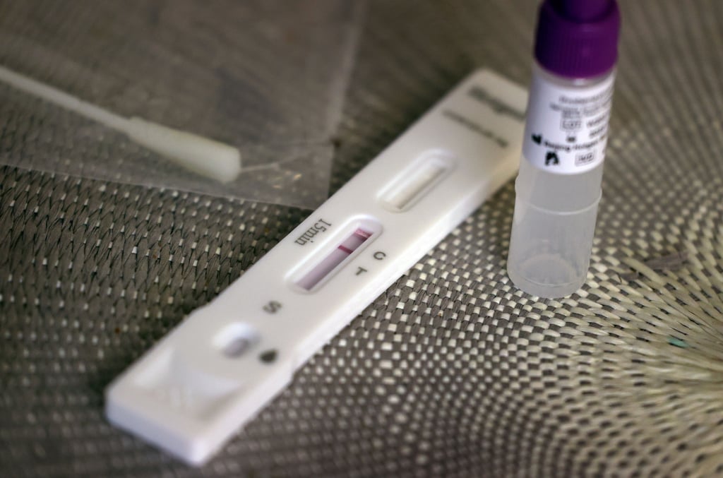 Ein Corona-Schnelltest.