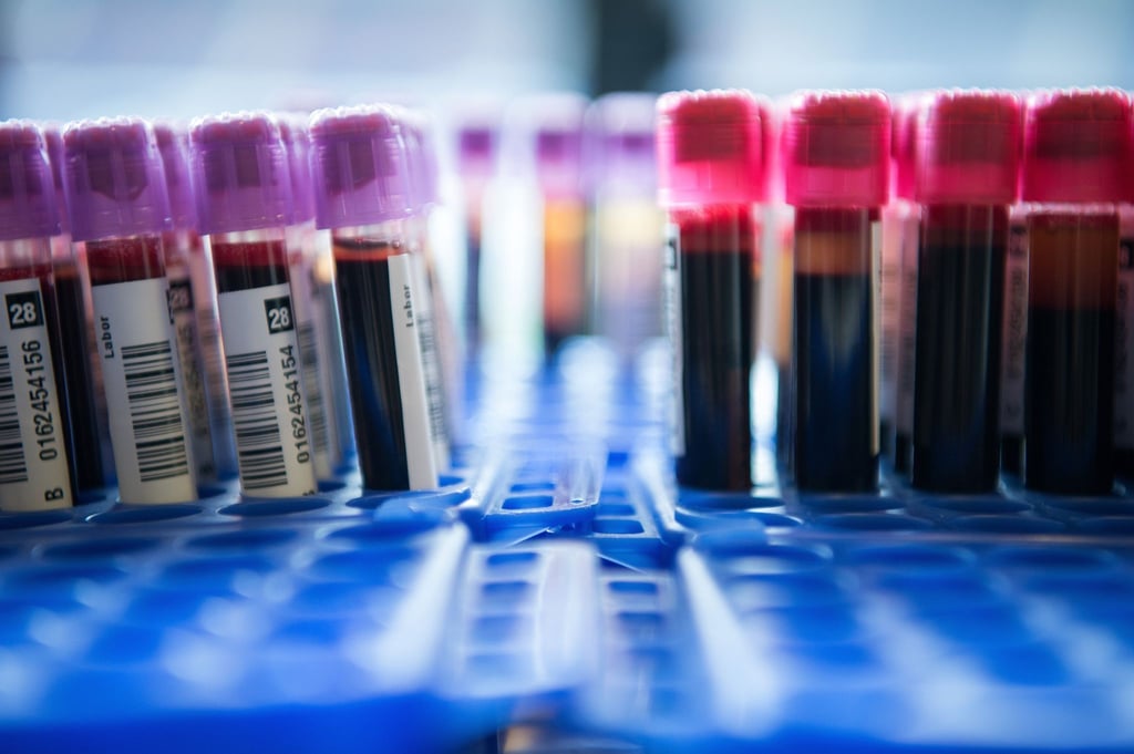 Spezielle Tests können Erbgut von Krebszellen im Blut nachweisen.