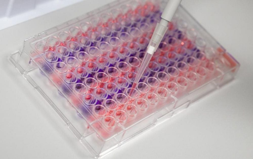 In einem Labor wird mit einer Pipette eine Corona-Testreihe vorbereitet.