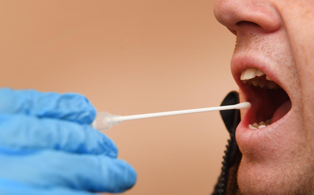 Die CDU will künftig vor Gericht DNA-Tests zur Altersbestimmung erlauben.