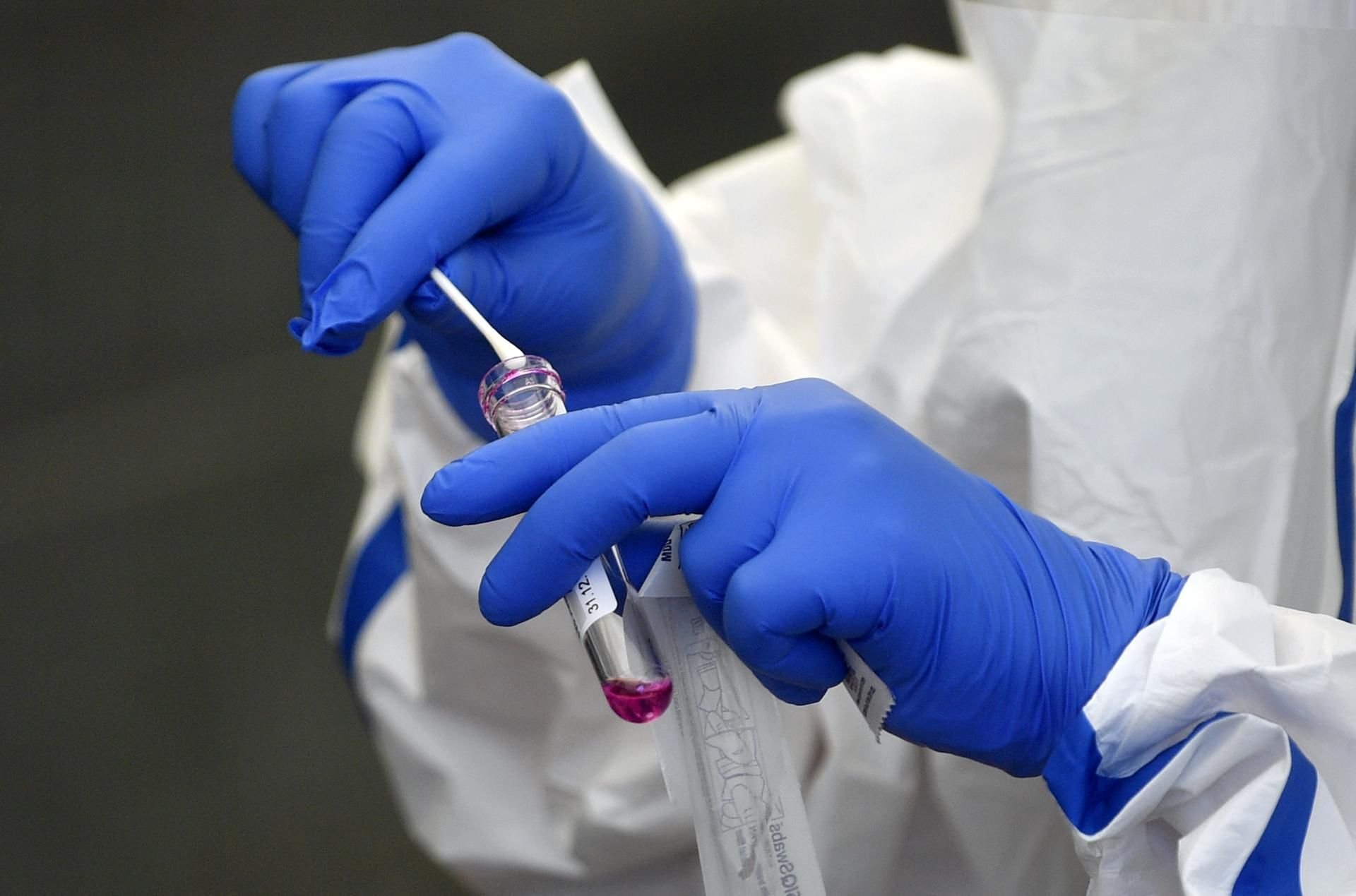 Mit neuen Einschränkungen will der Burgenlandkreis die Ausbreitung des Coronavirus eindämmen.