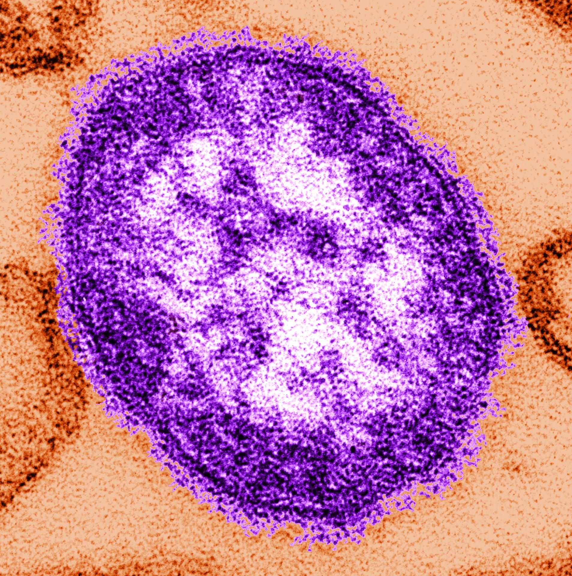 Teile eines Masern Virus