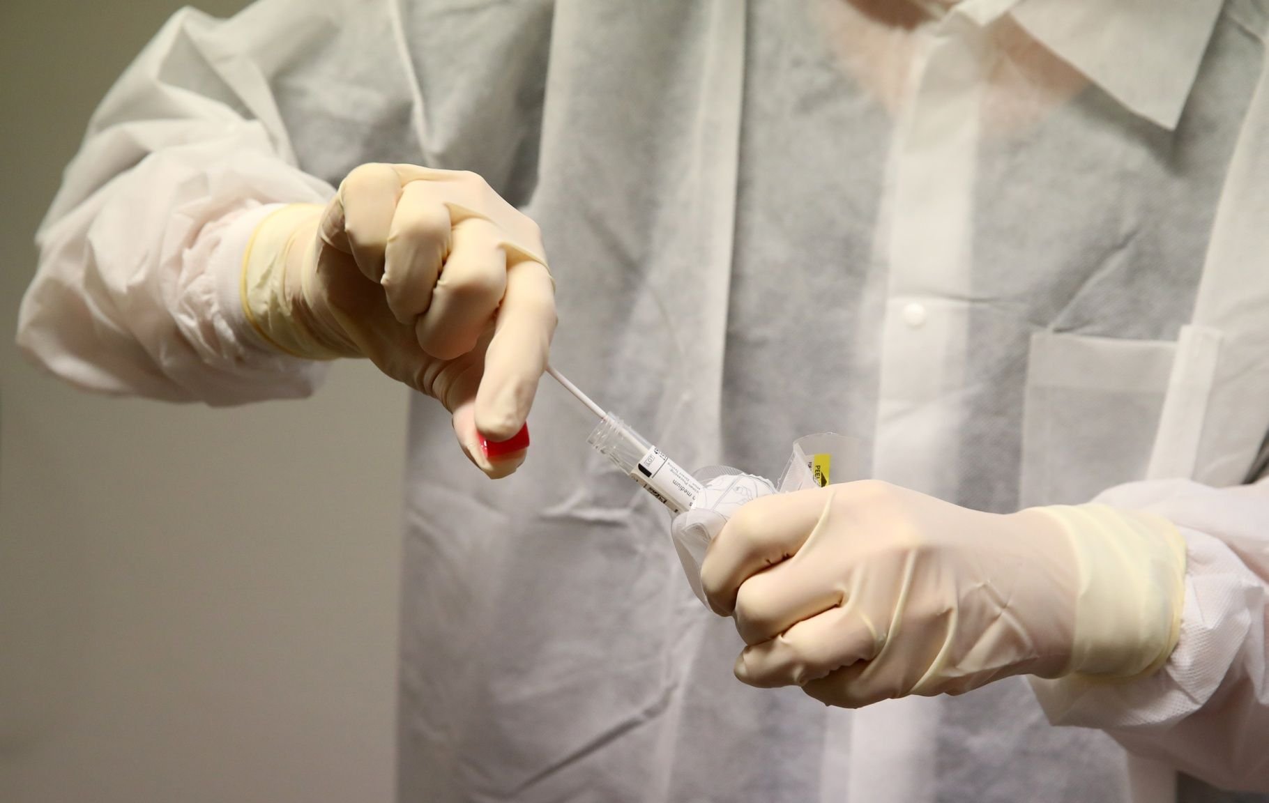 Eine Ärztin hat einen Abstrich von einem Patienten genommen.