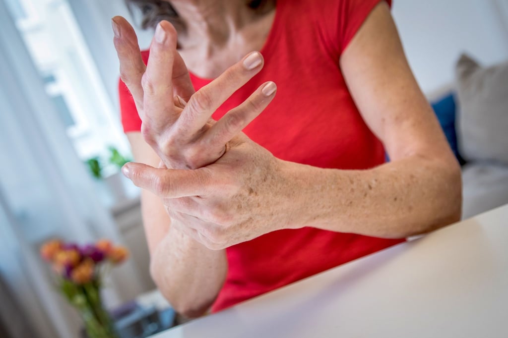 Frauen sind wesentlich häufiger von Osteoporose betroffen als Männer.