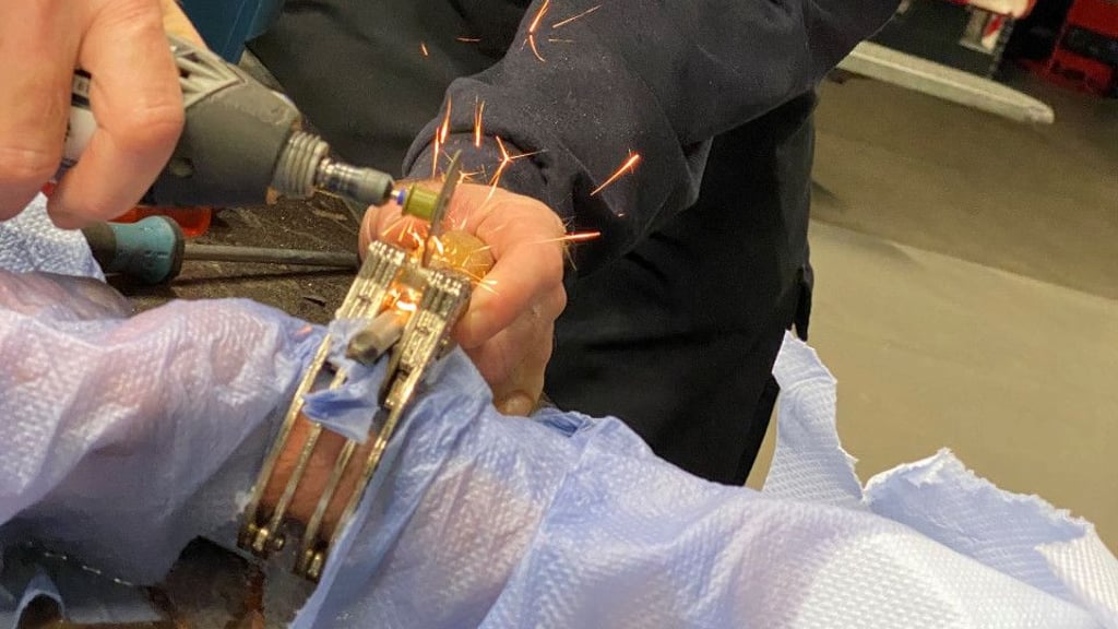 Am Ende wurde der junge Mann per Dremel befreit.