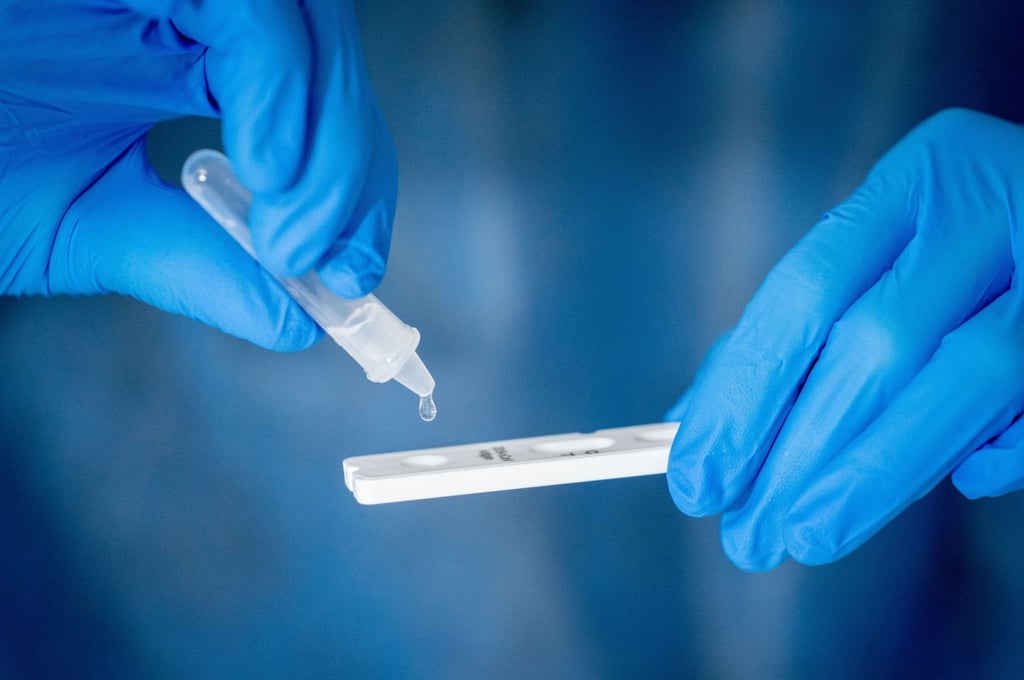 Medizinisch geschultes Personal führt einen Corona-Schnelltest durch.