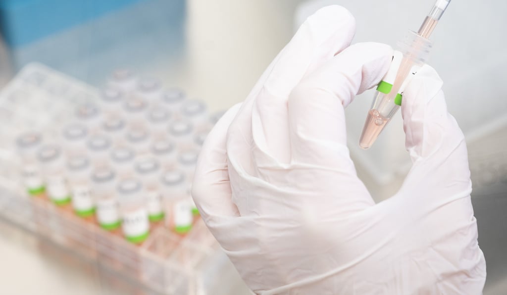 Eine biologisch-technische Assistentin bereitet PCR-Tests auf das Corona-Virus von Patienten für die Analyse vor.