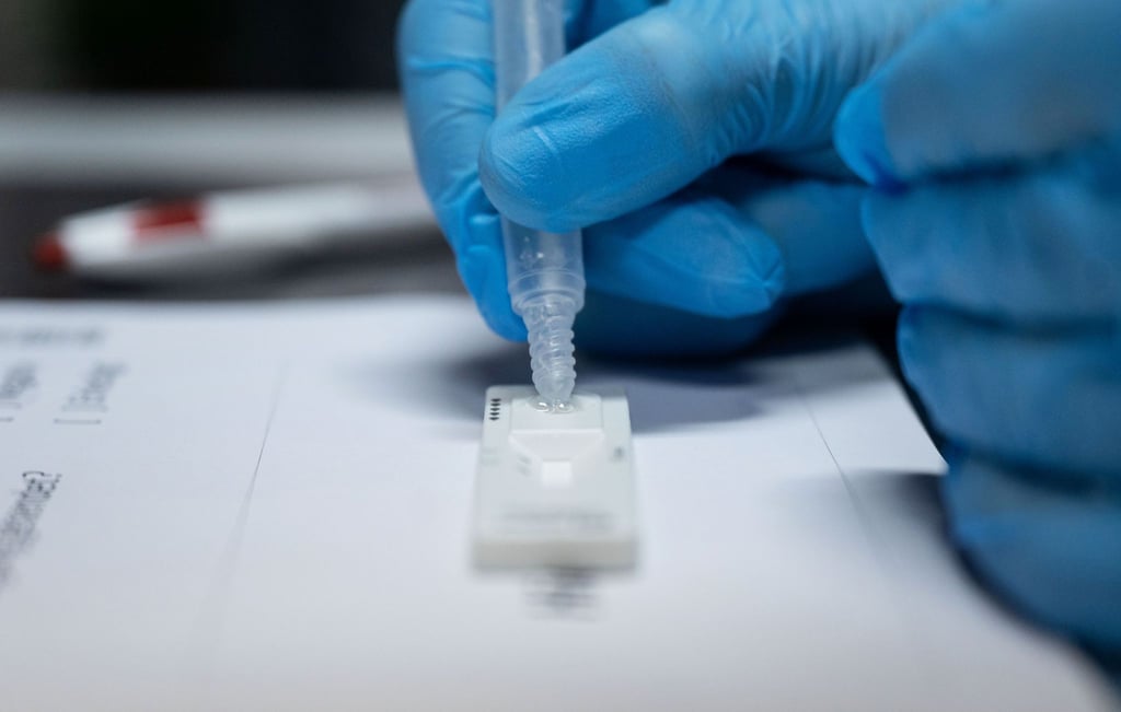 Für Kinder in Schulen und Kitas soll die Quarantäne als Kontaktperson fünf Tage dauern, mit abschließendem PCR- oder Schnelltest.