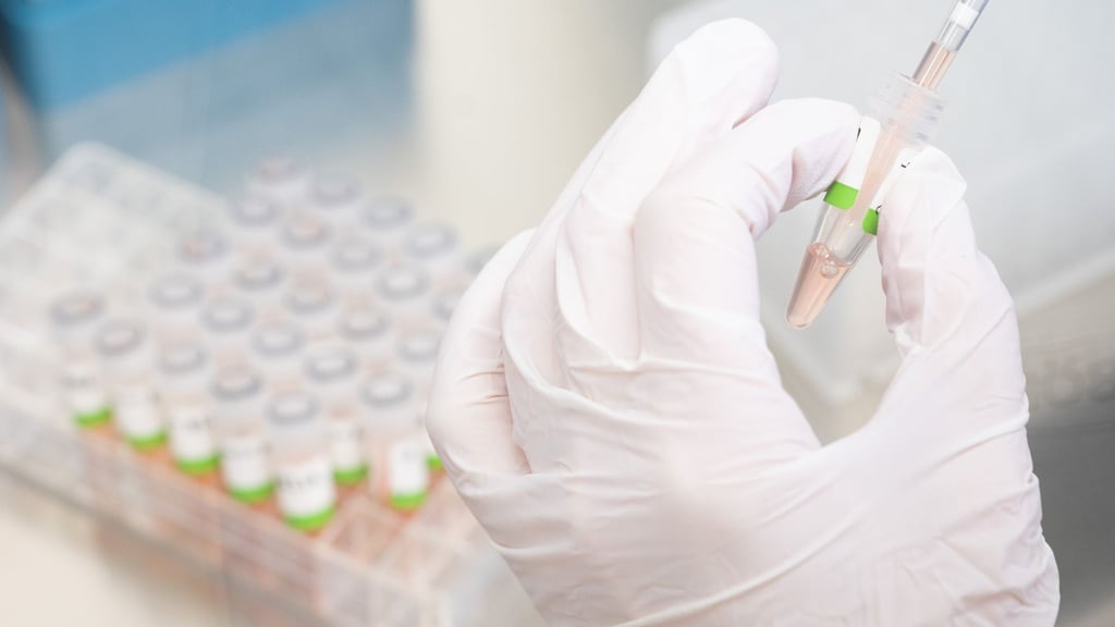 Angesichts der steigenden Zahl von Corona-Infektionen in Deutschland sollen nicht mehr alle per Schnelltest positiv Getesteten einen PCR-Test bekommen.