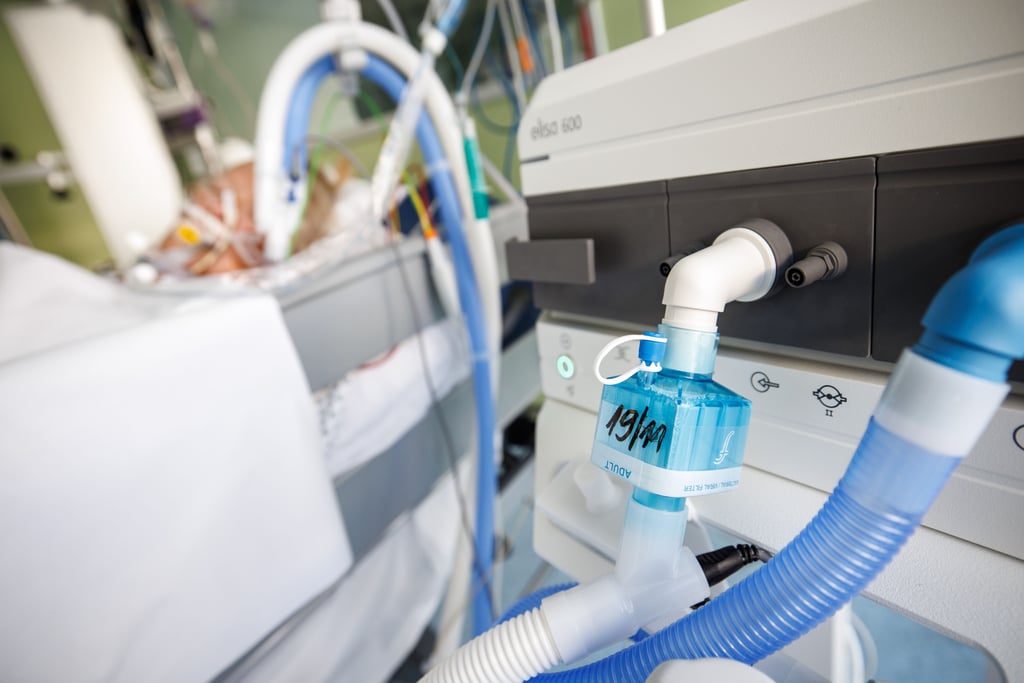 Beatmungsschläuche sind mit einem intubierten Corona-Patienten verbunden. (Symbolbild)