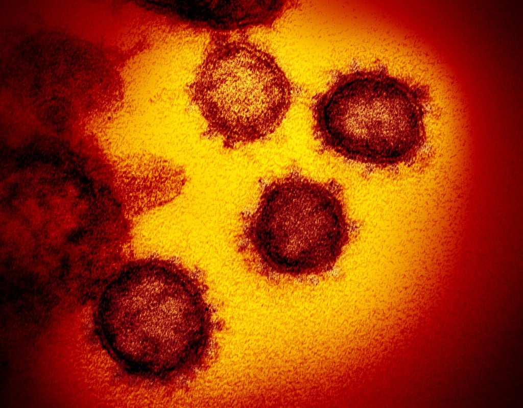 Das war noch der Wildtyp: Von einem Patienten in den USA Anfang 2020 isolierte Coronaviren.